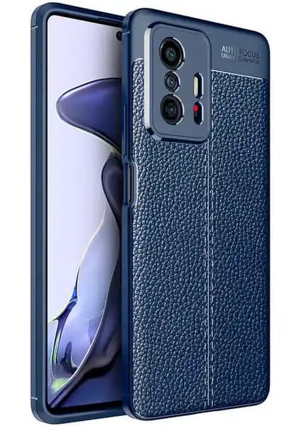Adige Xiaomi Mi 11T Niss Deri Görünümlü Silikon Kılıf İncelemesi ve Kullanıcı Yorumları