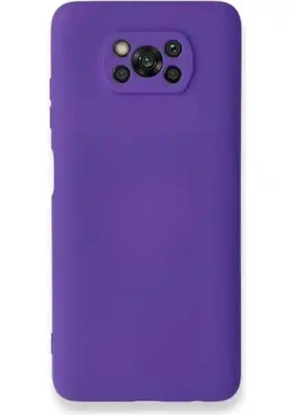 Xiaomi Poco X3 ve Poco X3 Pro Kılıflarının Detaylı Karşılaştırması ve Seçim Rehberi