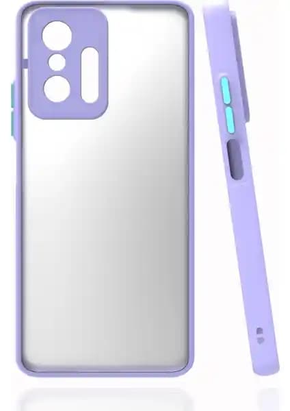 KNY Xiaomi Mi 11T Pro Renkli Kenarlı Buzlu Kamera Koruyucu Kılıf İncelemesi