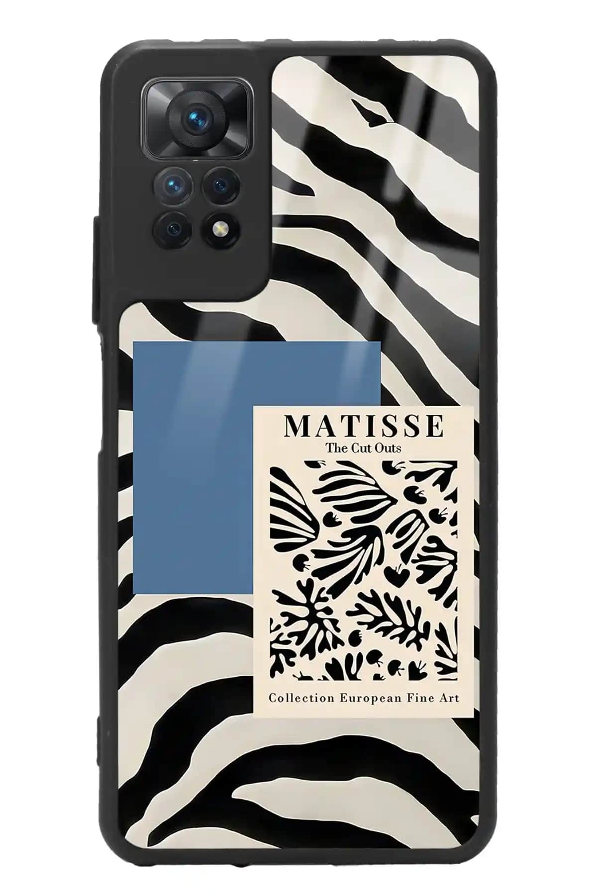 Spoyi Xiaomi Redmi Note 11 Pro Zebra Matissé Tasarımlı Glossy Telefon Kılıfı İncelemesi