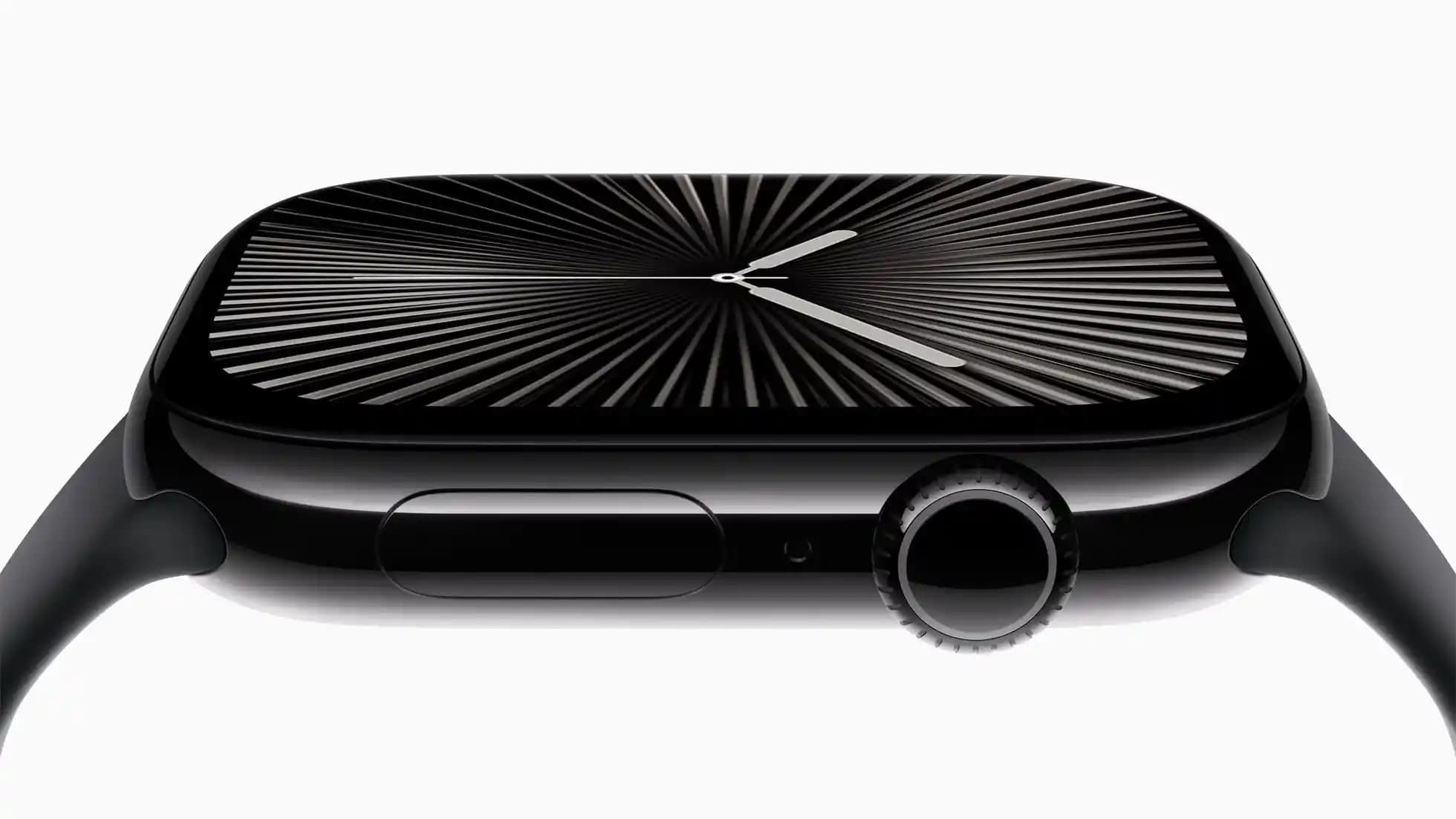 Apple Watch S Serisi Nedir ve Günlük Hayatta Sağladığı Avantajlar Nelerdir